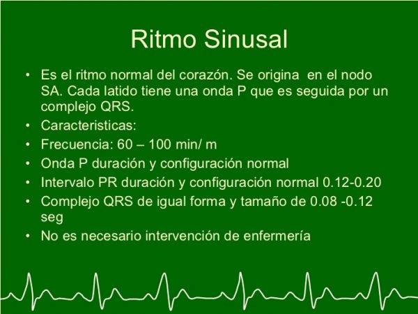 Que es el ritmo sinusal y como se identifica - Noticias Médicas