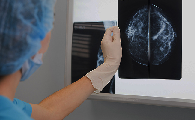 tecnología para la detección del cáncer