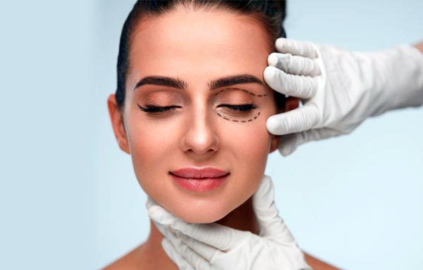 Blefaroplastia