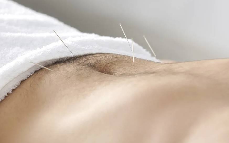 acupuntura para adelgazar