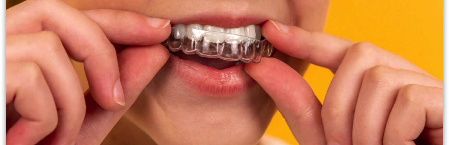 ortodoncia invisible Albacete
