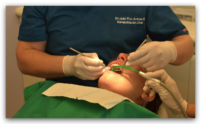 servicio blanqueamiento dental